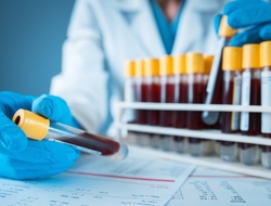 blood test blood test