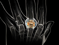 Pfizer Xeljanz rheumatoid arthritis RA joint damage Pfizer Xeljanz