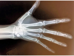 Sensors Insights 2018-02-22 Hero Near-Infrared Imaging Enables Machine-Vision Advances