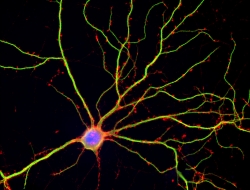 Mature neuron Mature neuron